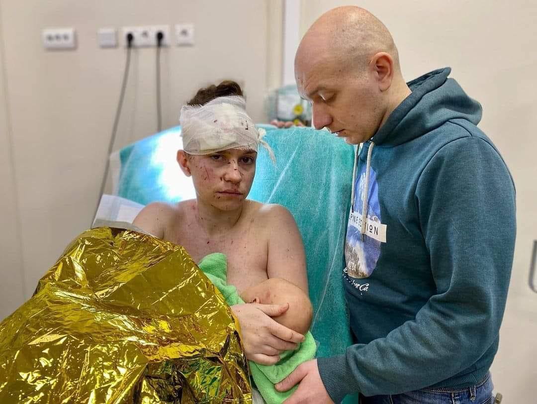 nexta_tv's tweet photo. During the shelling of #Kyiv, a mother covered her one-month-old daughter with her body and saved her. 

The woman herself sustained multiple shrapnel wounds, while the child remained unharmed.

The family was taken to a hospital where the woman and her husband were operated. https://t.co/Bm7P0o9NVD