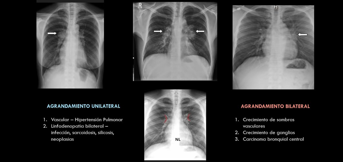 Sofade2ptos's tweet photo. La sesión de Radiología de hoy estuvo muy buena, les dejo mis 2 diapositivas favoritas
- Criterios para saber que una Rx PA Tórax es de calidad
- Orden de lectura propuesto para no saltarse partes.

(Créditos Dr Villalobos R1 Imagen) https://t.co/qPG4Wo3RtI