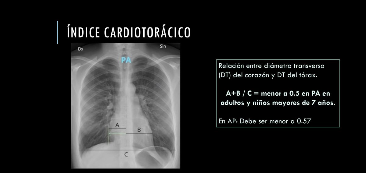 Sofade2ptos's tweet photo. La sesión de Radiología de hoy estuvo muy buena, les dejo mis 2 diapositivas favoritas
- Criterios para saber que una Rx PA Tórax es de calidad
- Orden de lectura propuesto para no saltarse partes.

(Créditos Dr Villalobos R1 Imagen) https://t.co/qPG4Wo3RtI