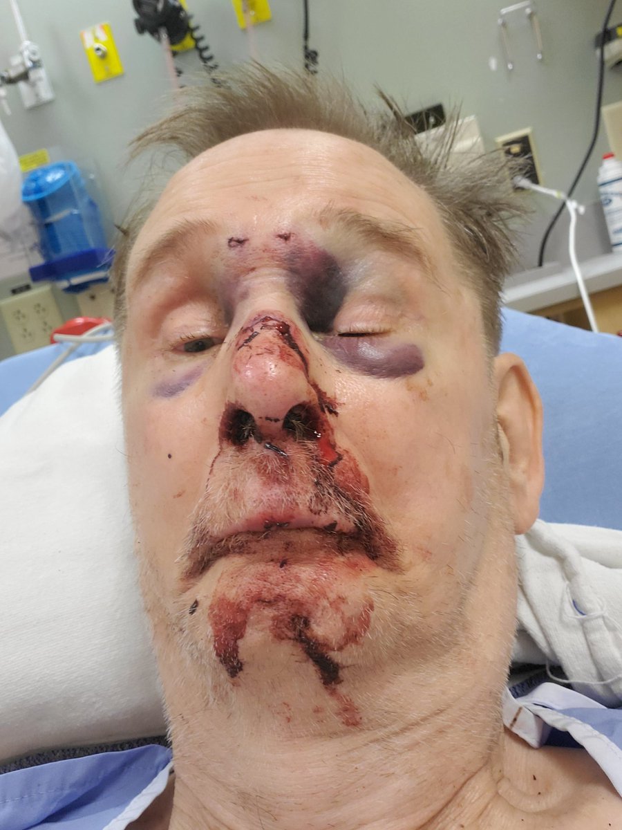 WithBiden1's tweet photo. You shoulda seen the other guy https://t.co/9jd7pzQFDM