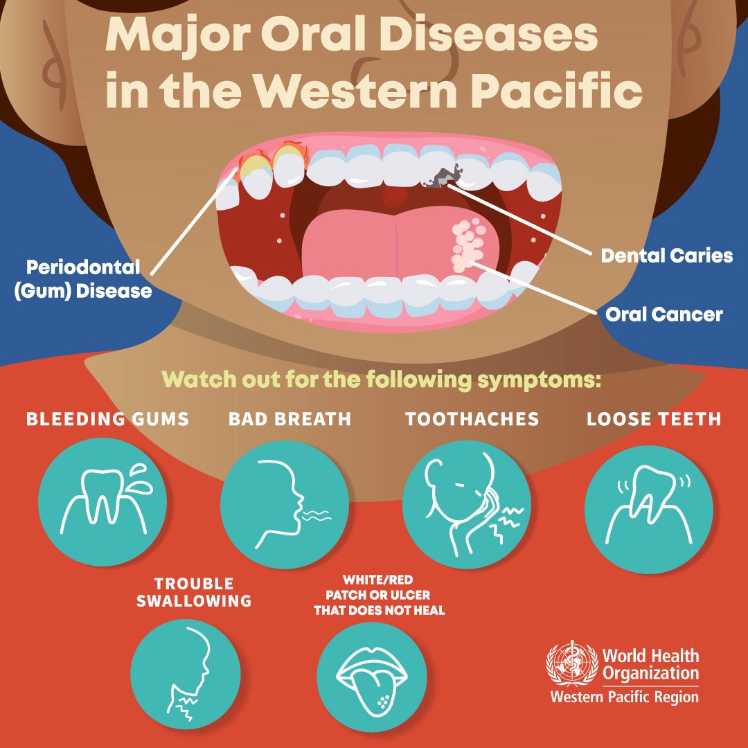 It’s #WorldOralHealthDay! 

2️⃣ in 5️⃣ people in the Western Pacific Region have some form of oral disease. 

#OralHealth