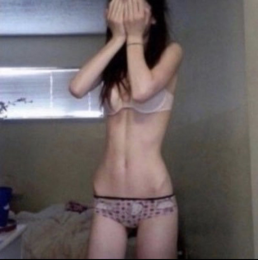 sinkingcorpse's tweet photo. ive been binging a lot lately :/ i need someone to trigger tf outta me 

🏷-edtwt thinspo fatspo egospo ricecaketwt meanspo sweetspo https://t.co/maJxMaUd2b