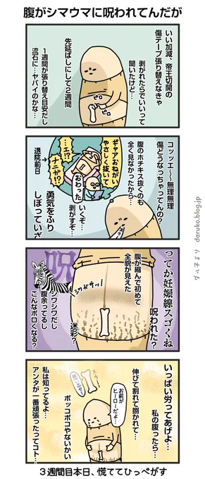 産後の腹、ボロッボロ。
https://t.co/ikYJfjyqhk
#産後 #漫画 