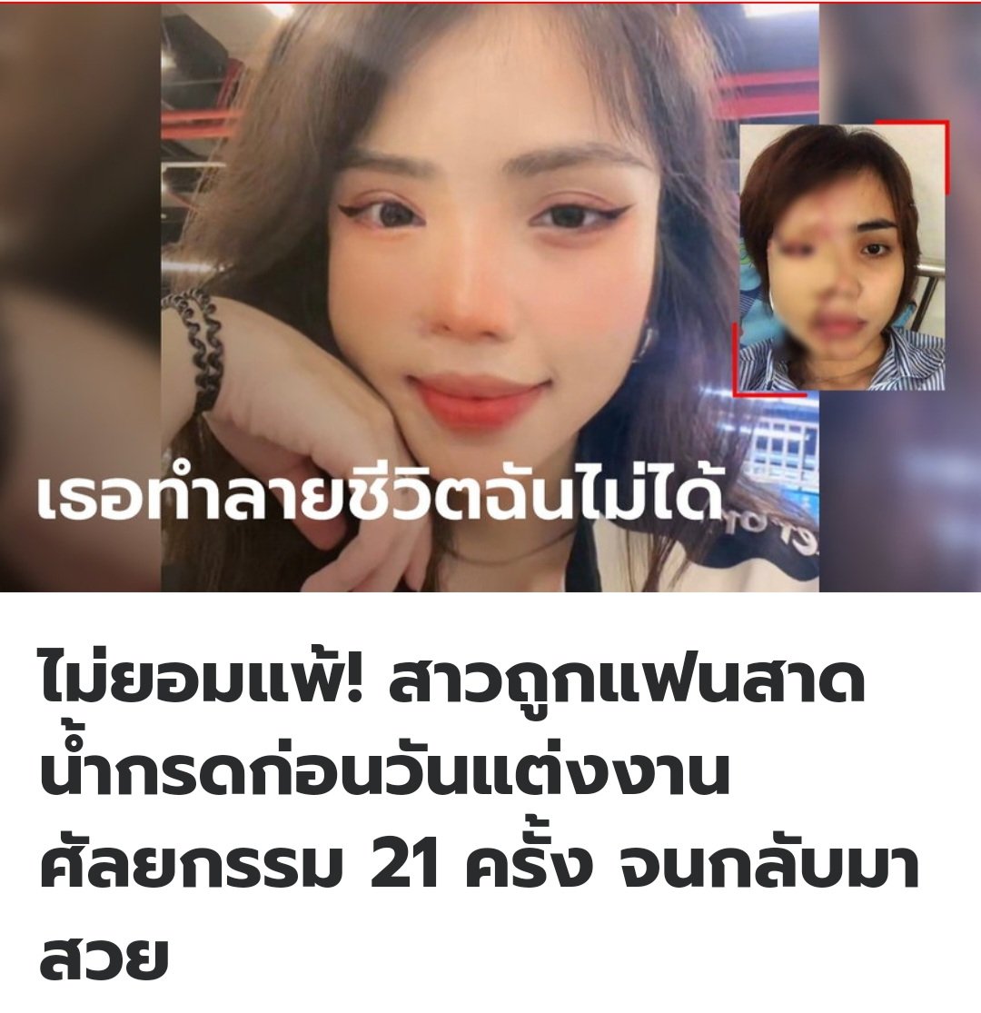 คุณผู้หญิงคนนี้ จิตใจเข้มแข็งมาก  จากนี้ขอให้มีแต่สิ่งที่ดีๆเข้ามาในชีวิตนะครับ!!