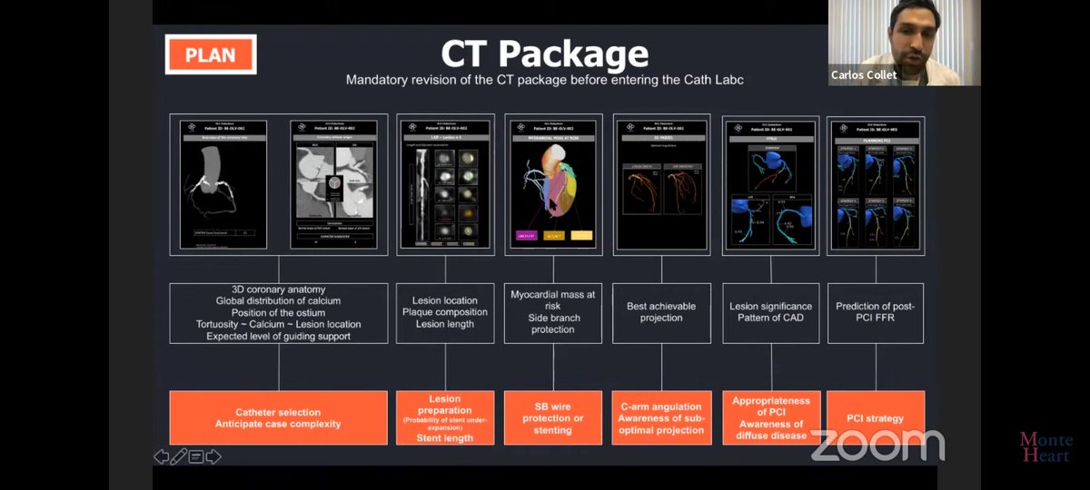 Montefiore Heart (@monteheart) on Twitter photo An incredible talk from Dr Collet <a href="/ColletCarlos/">Carlos Collet MD PhD</a> today!
A great overview and discussion on the integration of Coronary CT in the planning and execution of PCI.
If you missed it, you can watch it on our YouTube channel: youtu.be/ZuPpt071GsM An incredible talk from Dr Collet <a href="/ColletCarlos/">Carlos Collet MD PhD</a> today!
A great overview and discussion on the integration of Coronary CT in the planning and execution of PCI.
If you missed it, you can watch it on our YouTube channel: youtu.be/ZuPpt071GsM