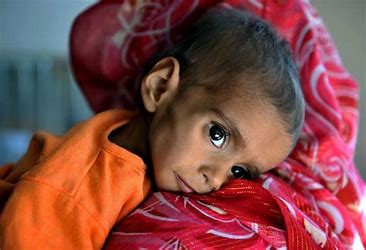 Nuestro destino depende de la clase, país, tiempo en el que hemos nacido

Observatorio de DDHH:  desde enero de 2022, 

unos 13.000 niñ<a href="/s/">『S』</a> en Afganistán han muerto de 

desnutrición y enfermedades relacionadas con el hambre, 

El 95% de la población no tiene suficientes alimentos.