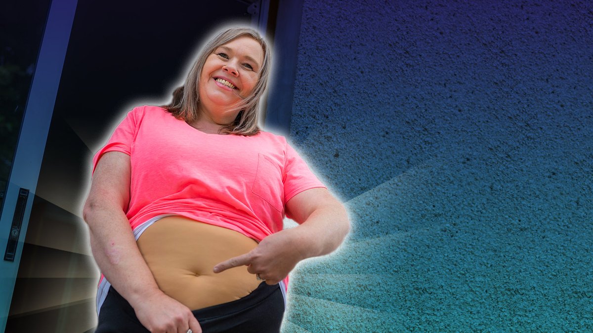 Believe it or not, that isn't Sandras real belly, thats the suit!
Come watch Secret Body NOW on the iplayer

bbc.in/3GNo69z 

<a href="/SecretBodyTV/">Secret Body</a> #secretbody #weightlossshow #weightlossjourney #scotland