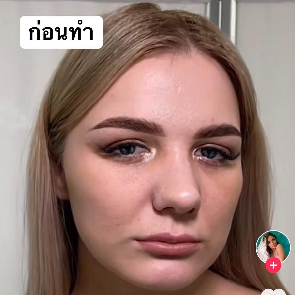 mintitapop's tweet image. วงการร้อยไหม ของ ประเทศ รัสเซีย นี่โหดสัสรัสเซียจริง จากคนหน้าอายุ 40-50
กลายเป็น 20-30 เลยอ่ะ นี่แคปมาจากคลิป คือ เขาไม่ได้แต่งรูปนะ ไม่แน่ใจว่า เป็นการร้อยไหมอย่างเดียวไหม น่าจะฉีดฟิลเลอร์+โบทอคด้วย แต่หน้าโคตรเปลี่ยน 100% (มีต่อ)