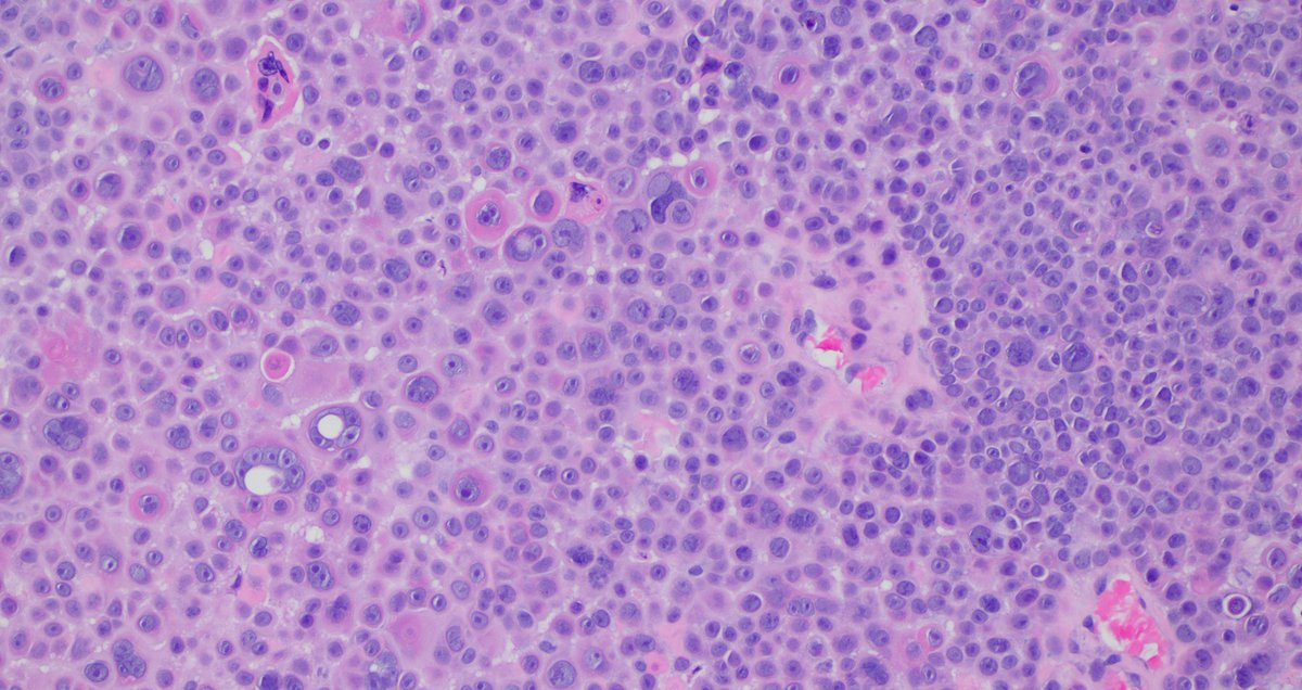 Signout Machine ⚙️ tweet media