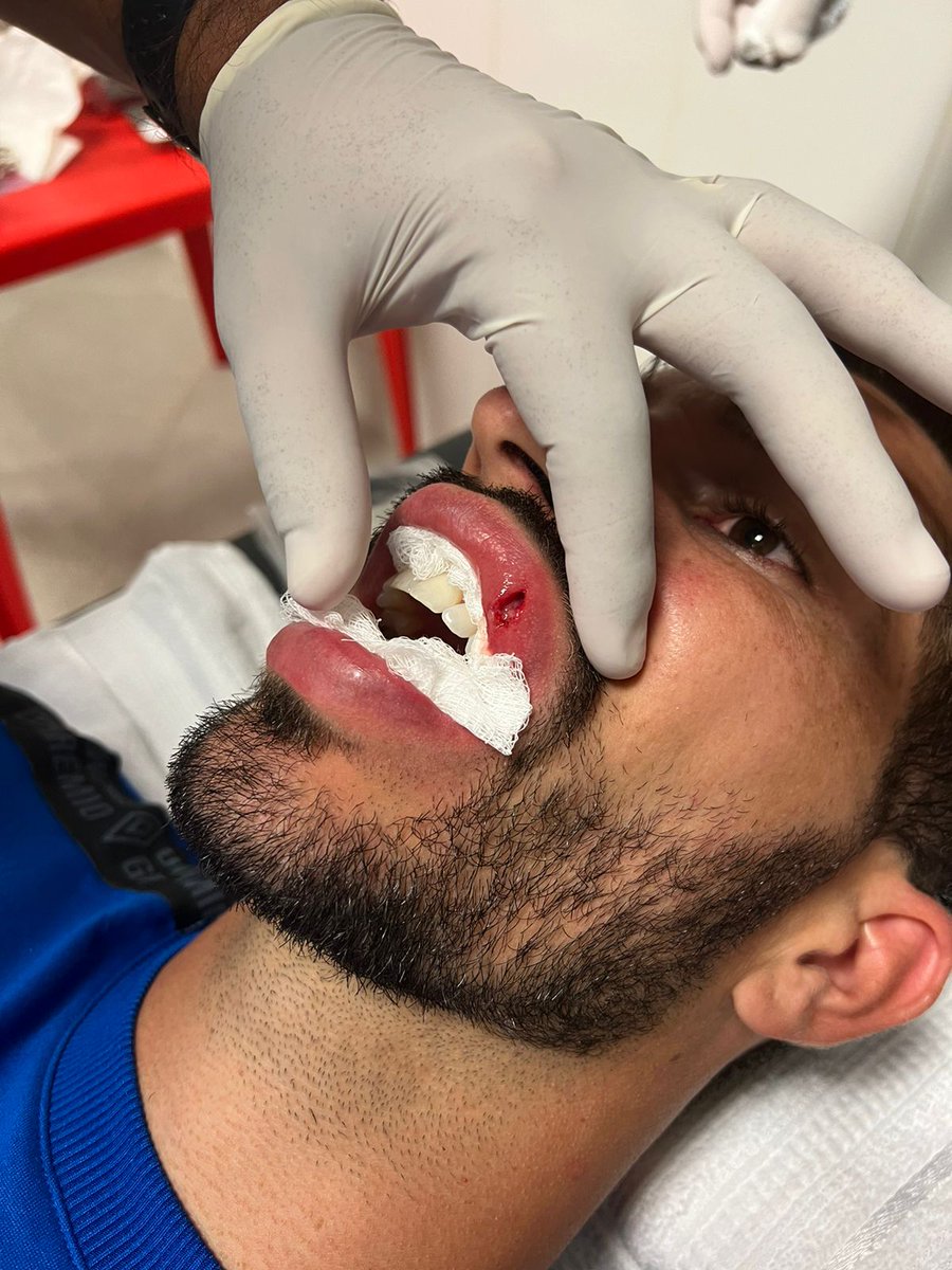 16LucasSilva's tweet photo. Mais um capítulo triste do nosso futebol. 

De tantos que já tivemos e que parece ter aumentado nos últimos dias. 

Estou bem, foram 3 pontos, mas o que fica é a chateação pelo ocorrido e a certeza de que ninguém será punido. https://t.co/UtJEJStEo6