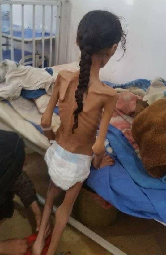 s_m_marandi's tweet photo. The US and EU have the audacity to attack Russia for war crimes.

Yemen is the mother of all war crimes. https://t.co/gUiryk3ZkN