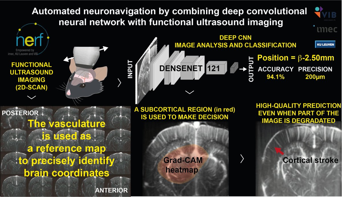 OpenfUS's tweet photo. Crucial milestone @__NERF toward automated registration of fUSI data: a deep CNN can accurately use Doppler images of the vasculature to identify the position in the brain within milliseconds!
https://t.co/91Th4a2mi2
#fUSI #CNN #neuronavigation #registration #allenbrainatlas https://t.co/UtUT5GBk13