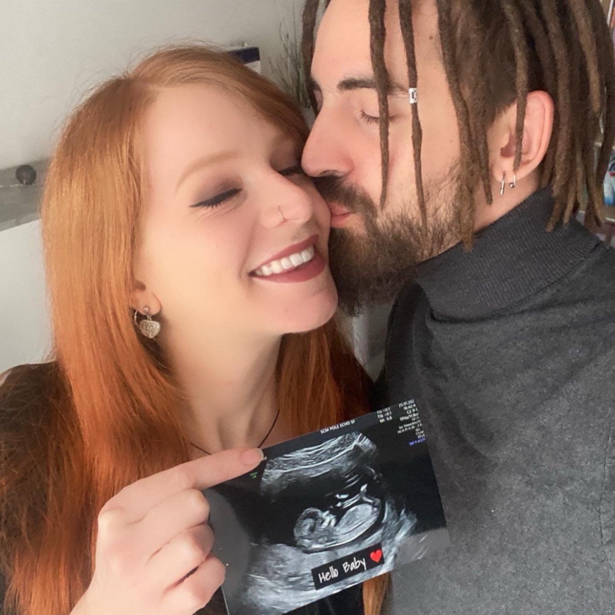 CynthiaMiaaou's tweet photo. ❤️🤰#HelloBaby 🤰❤️
Après des mois de silence, on s’est dit avec @TonyAma34964458 qu’il était temps de révéler notre secret 🤫 🗝😅
💗🌿 Le fruit de 7 ans d’amour 🙏🏻😌
#love #pregnant #20sa #babyiscoming #newlife #momtobe #dadvibes #parentstobe #lifegoals #couplegoals 💕 https://t.co/ACrc72wn0X