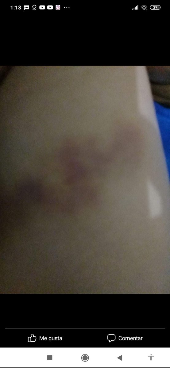 ContigoBrenda's tweet photo. Y si los tiene no los pone en práctica. 
Yo también fui víctima de la U. Sufrí acoso, cierto día un docente incluso me maltrató físicamente . Me jaloneó por toda el aula hasta dejarme el brazo morado , mis compañeros no querían "jugarse" su nota y nunca me respaldaron pero https://t.co/VvfoYTAOqj