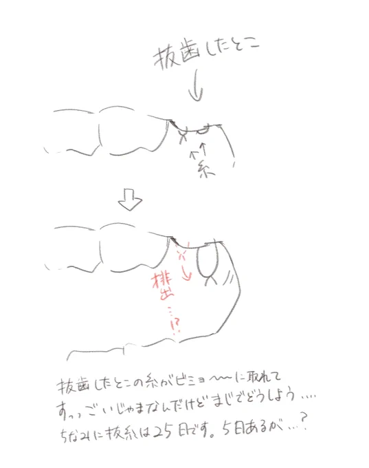 どうしよう……(日記) 