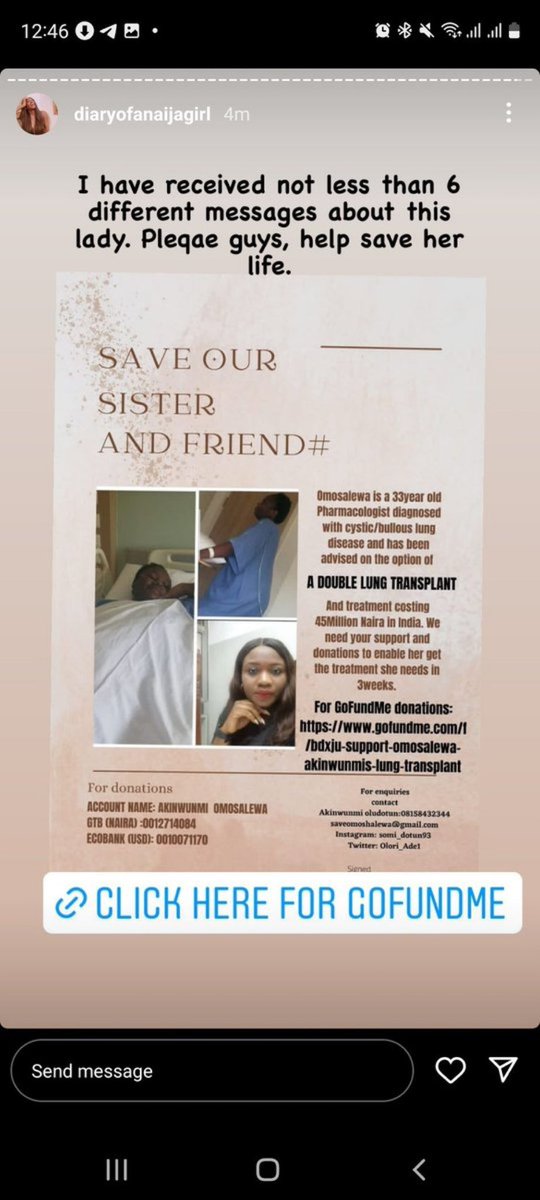 Sunil_Sawhney's tweet photo. #TooImportantNotToShare
I normally do not make such appeals until I am personally sure that it is genuine.

Please help assist this young lady who has been a promising professional &amp; now requires a lung transplant at a cost of naira 45 mln.

Pl do your bit to #SaveOmosalewa https://t.co/OIl8G8IUaq