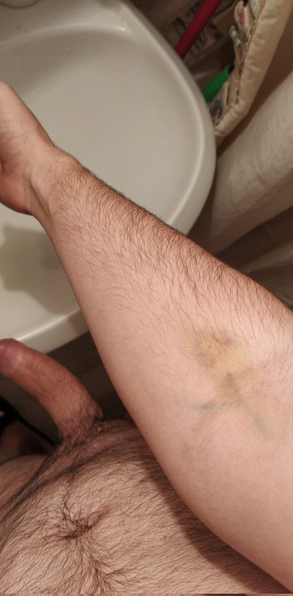 Greek_boy_20's tweet photo. Το χεράκι μου ρε παιδιά 😩 https://t.co/lvZ8tfcKZO