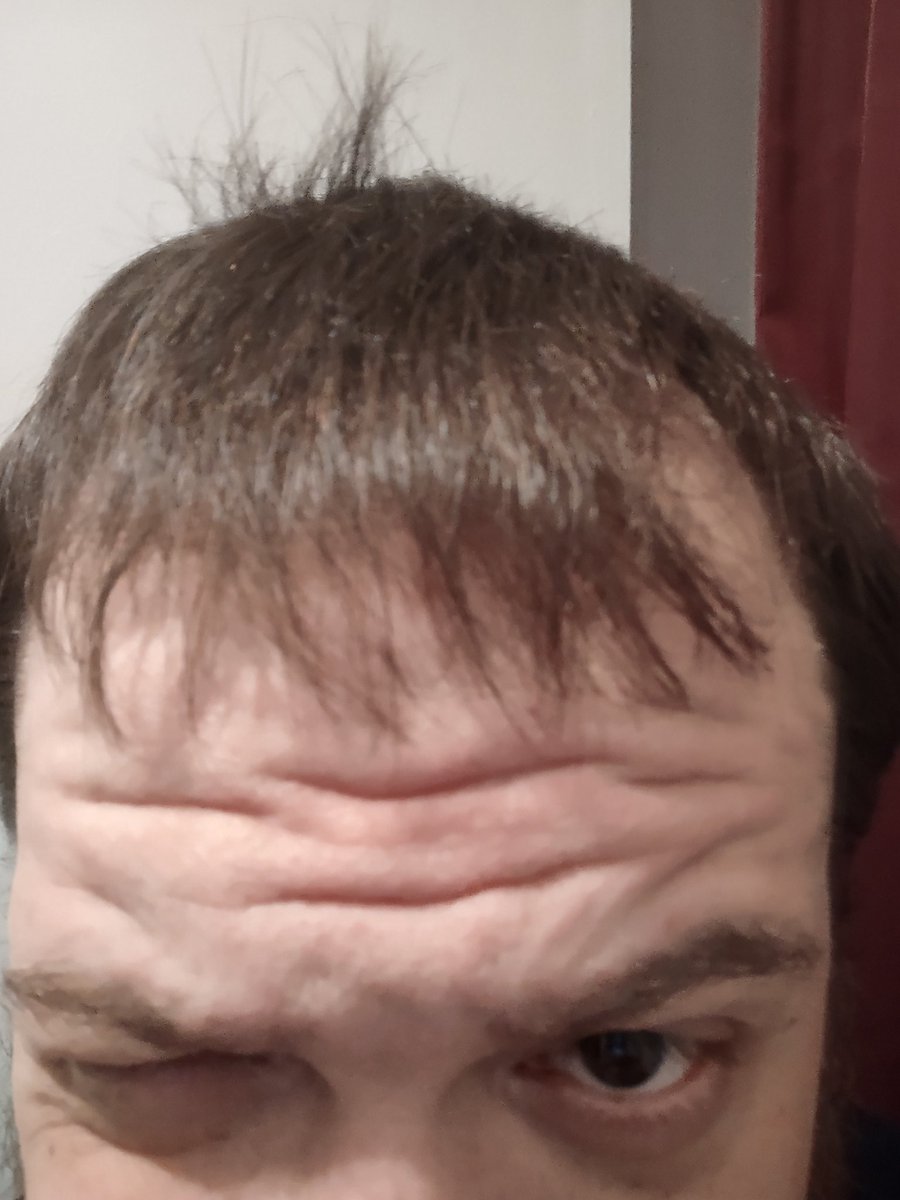 DeadonDave's tweet photo. There's a story here.
Wanted to take a "normal" shot
Chose that face as my normal.
Tried again...
Tried again, thought I was cute...
The hair said I'VE BEEN HERE ALL ALONG! https://t.co/DeySUYXm6q