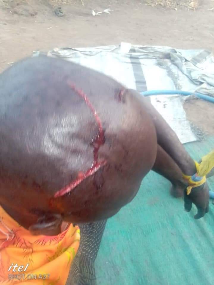 LaduJoy's tweet photo. Haven't had the strength to post here since yesterday's attack by a group of cattle herders shock. 

 Attempts to peacefully talk to them to get the herd from destroying our crops nearly got myself and my staff killed.

Below are injuries that my staff and I sustained. https://t.co/NgL57XfV8M