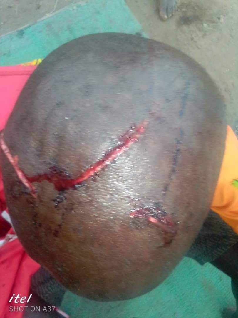 LaduJoy's tweet photo. Haven't had the strength to post here since yesterday's attack by a group of cattle herders shock. 

 Attempts to peacefully talk to them to get the herd from destroying our crops nearly got myself and my staff killed.

Below are injuries that my staff and I sustained. https://t.co/NgL57XfV8M
