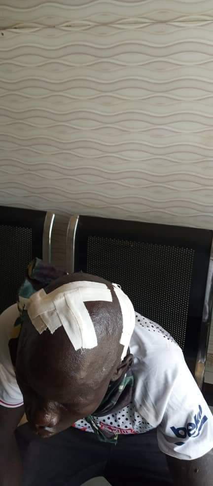 LaduJoy's tweet photo. Haven't had the strength to post here since yesterday's attack by a group of cattle herders shock. 

 Attempts to peacefully talk to them to get the herd from destroying our crops nearly got myself and my staff killed.

Below are injuries that my staff and I sustained. https://t.co/NgL57XfV8M