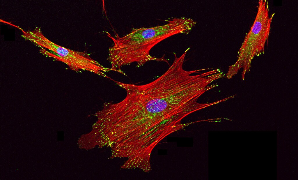 MesenchymalCell's tweet photo. New research reveals that Lepr+ #mesenchymal cells are important mediators linking systemic diet changes to local #IntestinalStemCell function and might serve as a novel therapeutic target for gut diseases.

📘 @cell_res | 🔗 https://t.co/FE17eYQrkn https://t.co/gwI9q8ELQc