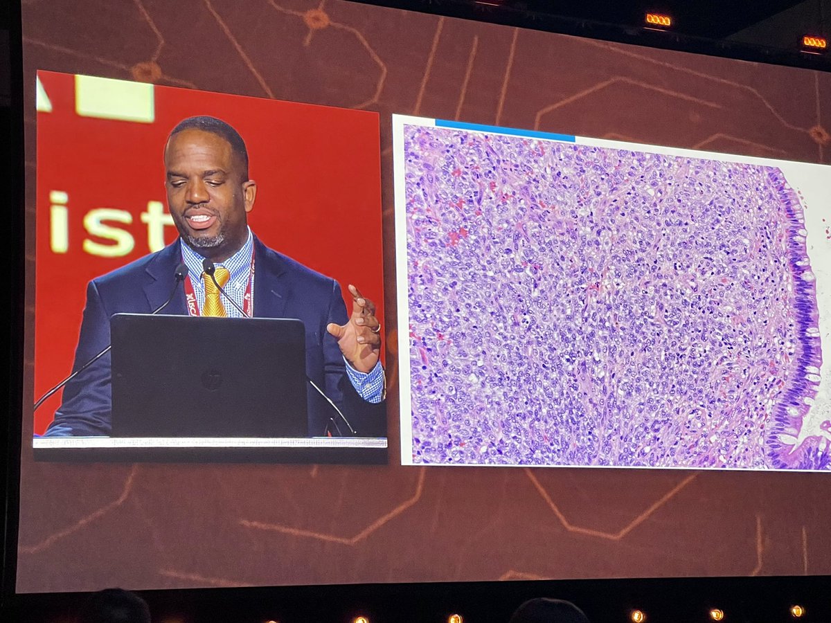 Jennifer Boland, MD (@jenniferboland7) on Twitter photo Amazing talk by my colleague Dr. <a href="/rondell_graham/">Rondell Graham</a> regarding how his general surgical pathology training <a href="/MayoClinicPath/">Mayo Clinic Pathology</a> helps him in his GI subspecialty sign out <a href="/TheUSCAP/">USCAP</a> Arthur Purdy Stout companion meeting Amazing talk by my colleague Dr. <a href="/rondell_graham/">Rondell Graham</a> regarding how his general surgical pathology training <a href="/MayoClinicPath/">Mayo Clinic Pathology</a> helps him in his GI subspecialty sign out <a href="/TheUSCAP/">USCAP</a> Arthur Purdy Stout companion meeting