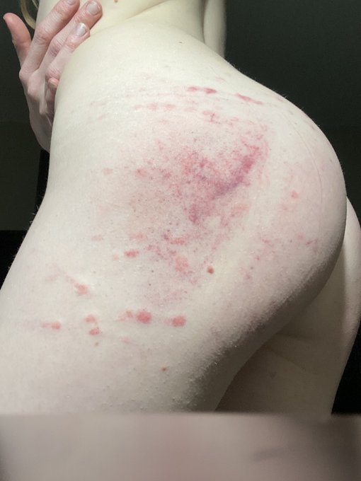 I&rsquo;ll take bruises over flowers any day https://t.co/IDrGXYr9NZ<a href="/tag/spanking"class="tags"><span>#spanking</span></a><a href="/tag/upskirt"class="tags"><span>#upskirt</span></a><a href="/tag/retweet"class="tags"><span>#retweet</span></a>