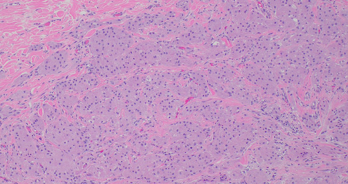 Signout Machine ⚙️ tweet media