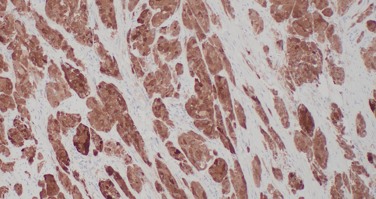 Signout Machine ⚙️ tweet media