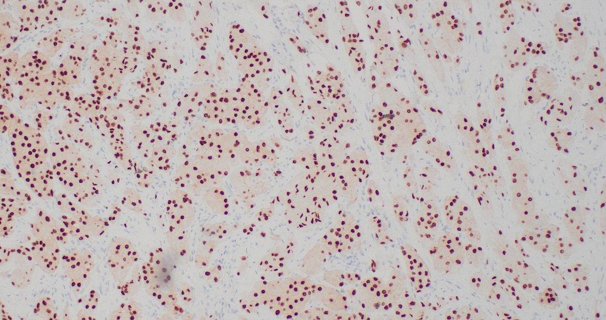 Signout Machine ⚙️ tweet media