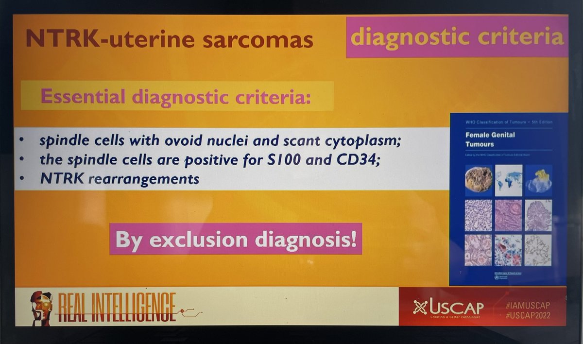 JNStallMD's tweet photo. The final @TheUSCAP @ISGynP presentation is a an update on fibrosarcoma-like uterine sarcomas! @CroceMd gives an elegant overview of NTRK-uterine sarcomas #USCAP2022 #gynpath https://t.co/ffbudRPYLd