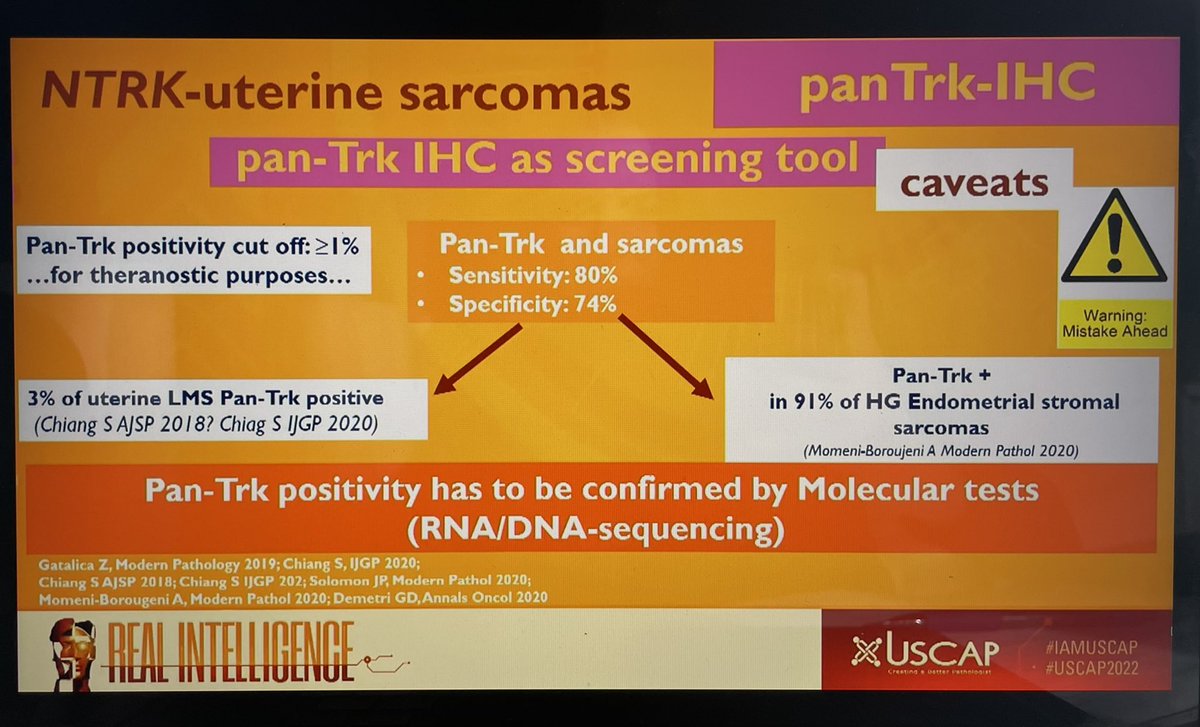 Jennifer N Stall, MD (@jnstallmd) on Twitter photo The final <a href="/TheUSCAP/">USCAP</a> <a href="/ISGynP/">International Society of Gynecologic Pathologists</a> presentation is a an update on fibrosarcoma-like uterine sarcomas! <a href="/CroceMd/">Sabrina Croce MD</a> gives an elegant overview of NTRK-uterine sarcomas #USCAP2022 #gynpath The final <a href="/TheUSCAP/">USCAP</a> <a href="/ISGynP/">International Society of Gynecologic Pathologists</a> presentation is a an update on fibrosarcoma-like uterine sarcomas! <a href="/CroceMd/">Sabrina Croce MD</a> gives an elegant overview of NTRK-uterine sarcomas #USCAP2022 #gynpath