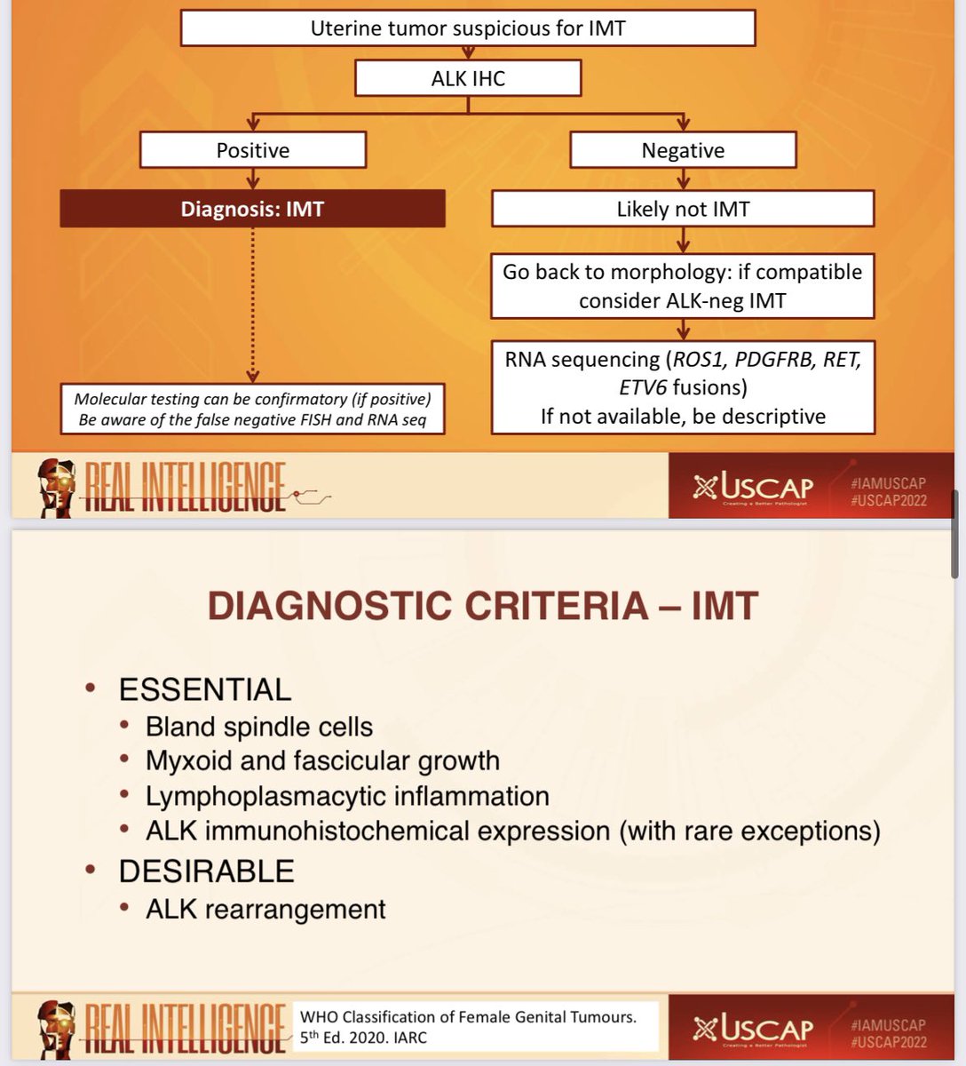 JNStallMD's tweet photo. .@CPHpath reviews the current spectrum of uterine myxoid mesenchymal uterine neoplasms and the WHO criteria for diagnosing entities in the differential @TheUSCAP @ISGynP companion society meeting! #USCAP2022 #gynpath https://t.co/zcTgS4W5md