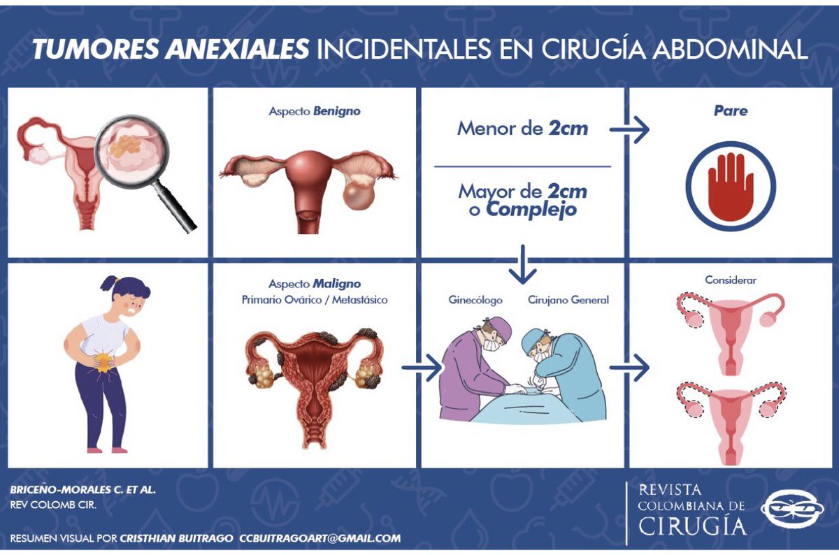 Neoplasias apendiculares incidentales en cirugía de urgencia. Segunda entrega de la serie “Decisiones oncológicas durante cirugía abdominal de urgencia”. Fellow cirugía oncológica  INC (UMNG-UPJC) <a href="/INCancerologia/">Instituto Nacional de Cancerología</a> <a href="/maurogmora/">Mauricio Garcia Mora</a> <a href="/donpipe66/">Felipe Gonzalez</a> <a href="/revcolcirugia/">Revista Colombiana de Cirugia</a>