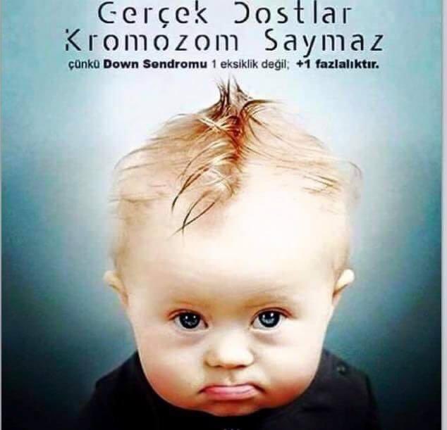 nurcan976's tweet photo. #downsendromu 

 eğitim ile hayata uyum sağlar ve meslek edinebilirler. Onlarda hasta gibi bakmayın. Hatta dönüp dönüp bakmayın. Acır gibi de bakmayın.  Çocuklarınızı onlardan uzaklaştırmayın. Sizden benden ondan farklı değiller. Gerçek dostlar kromozom saymazlar. Unutmayın https://t.co/QwcvkZhL2p