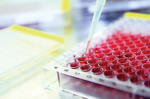 elainaledoyen's tweet photo. #ELISAAssayDevelopment or a Kit: What Should You Choose? Read the article to understand how #CustomAssay experts can help in the development process of ELISA assay.
#CellBasedAssays #ELISAAssaysKit #ELISA
https://t.co/sXcJ13FyfG https://t.co/SWvoZiXUw1