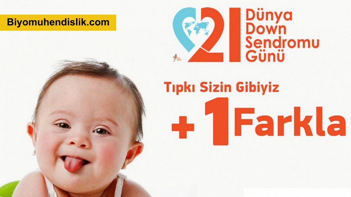 Tıpkı sizin gibiyiz...   +1 farkla   

#21MartDownSendromuFarkındalıkGünü  #DownSendromu