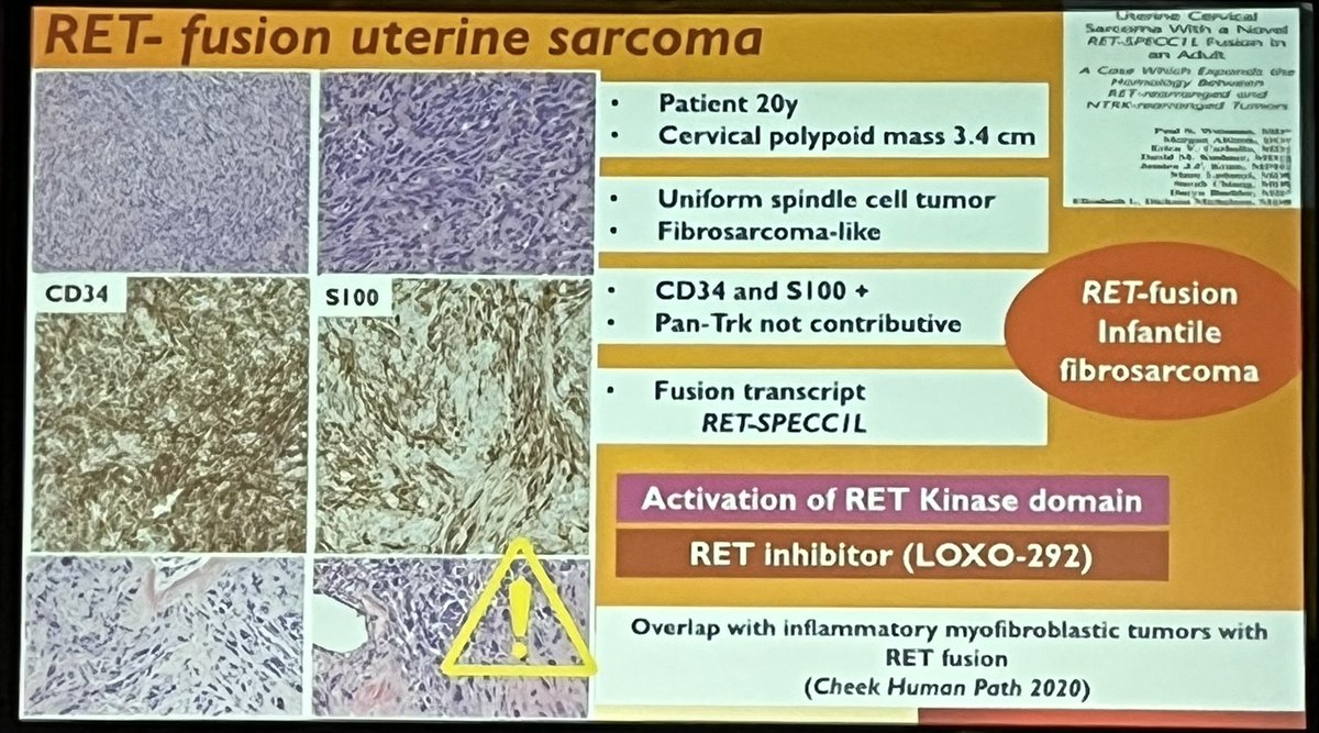 RET FISH may have a growing role in mesenchymal Gyn cases!  <a href="/crocesabrina1/">croce sabrina</a> <a href="/TheUSCAP/">USCAP</a> <a href="/ISGynP/">International Society of Gynecologic Pathologists</a>  #gynpath