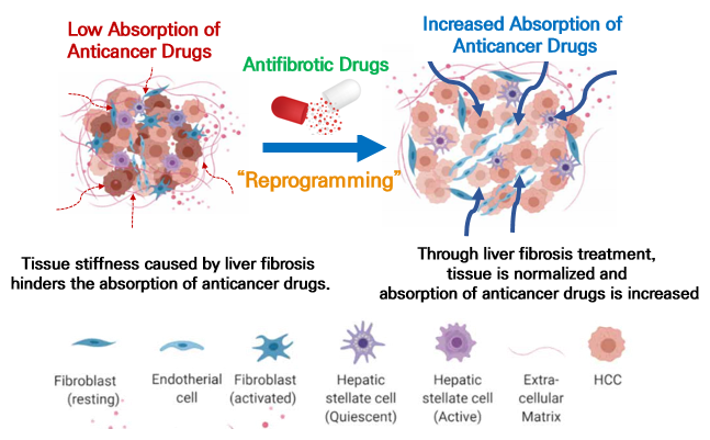 [Korea #Cancer #Prevention Day (Mar 21)] IPK's new paradigm to tackle #livercancer: Combining the #antifibrotic drugs with #anticancer drugs to reprogram the hardened tissue to a normal state aiming to increase the absorption of anticancer drugs. bit.ly/36c07Vn