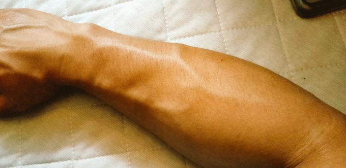 クリオナで中指動かしすぎて、 前腕が張りました。 でもやめられない。 https://t.co/T2qFqcqFoX