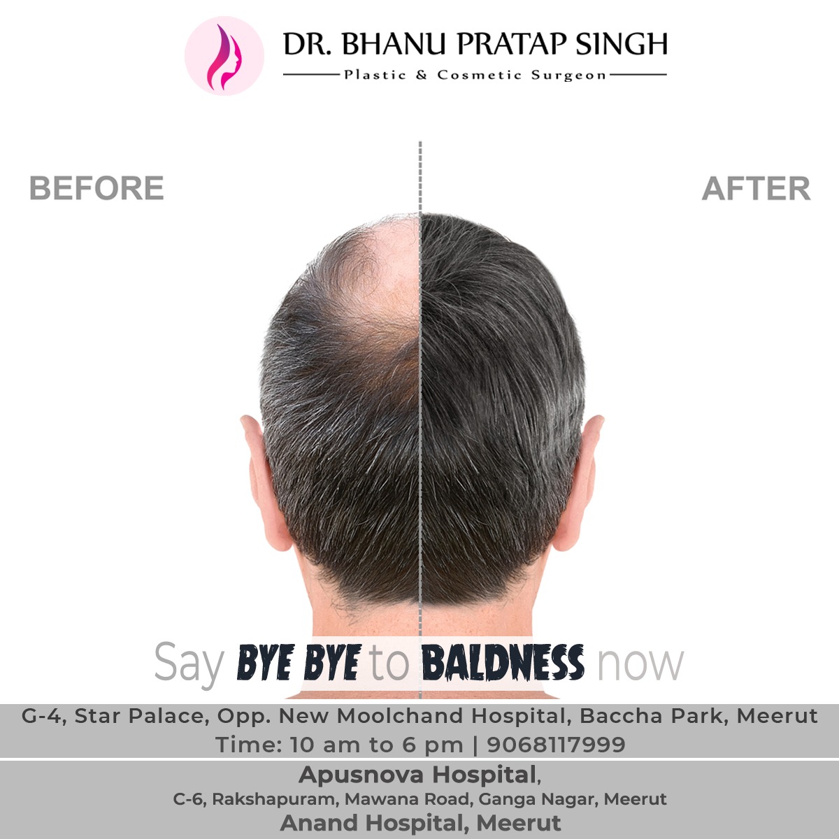 Dr Bhanu Pratap Singh on Twitter: Dr Bhanu Pratap Singh on Twitter: