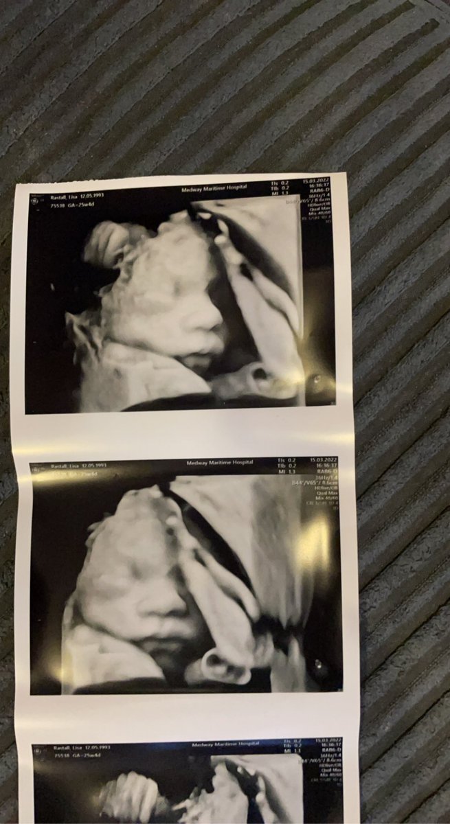 Xlisa18X's tweet photo. Can’t wait to meet you baby boy mummy and your big sister are so excited only 3 months to go due date 24th June 2022 can’t wait x 💙 https://t.co/YDg5kEOmTY