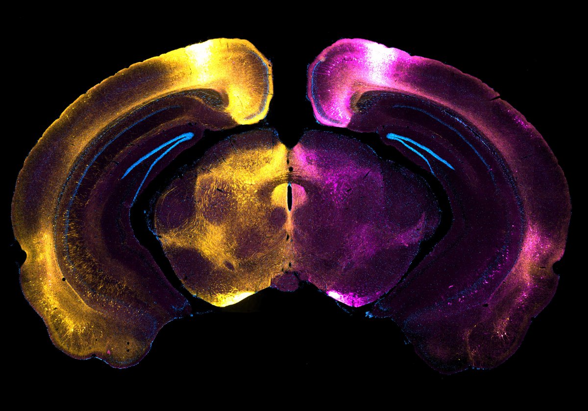 GraeffJohannes's tweet photo. New week, new preprint! Together with (twitterless) Lucie Dixsaut we show that inputs to the medial prefrontal cortex shift in activity and importance during memory #consolidation, with new roles for the #claustrum and #insula. 🧠💡🔥https://t.co/GpCwVIOHCv https://t.co/G3OQuwkh1d