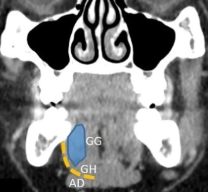 Peter Fiester, MD tweet media