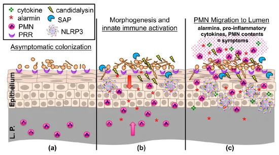 JoF_MDPI's tweet photo. A review entitled “Vulvovaginal #Candidiasis: A Current Understanding and Burning Questions” from Brian M. Peters et al.

View full text at https://t.co/AadfNOuO1z https://t.co/6g3lWwjBes