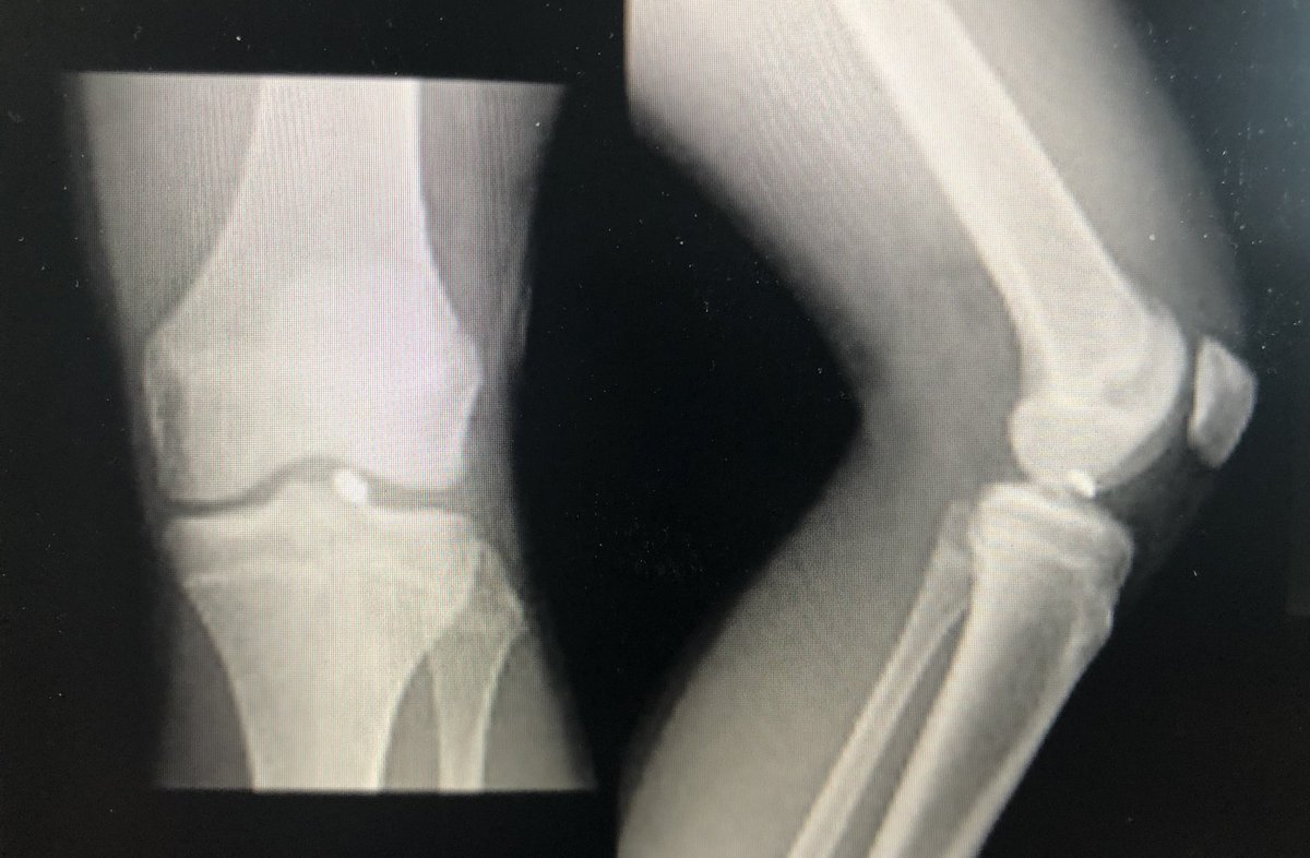 Clayton Nuelle, MD, FAAOS tweet media