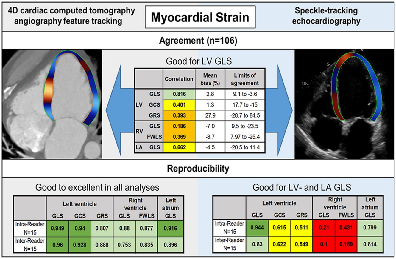 Journal of Cardiovascular CT on X: Agreement is strong between 4D CCT and  speckle tracking echocardiography only for LV global longitudinal strain.  Other features demonstrated mod or weak correlation. #yesCCT
