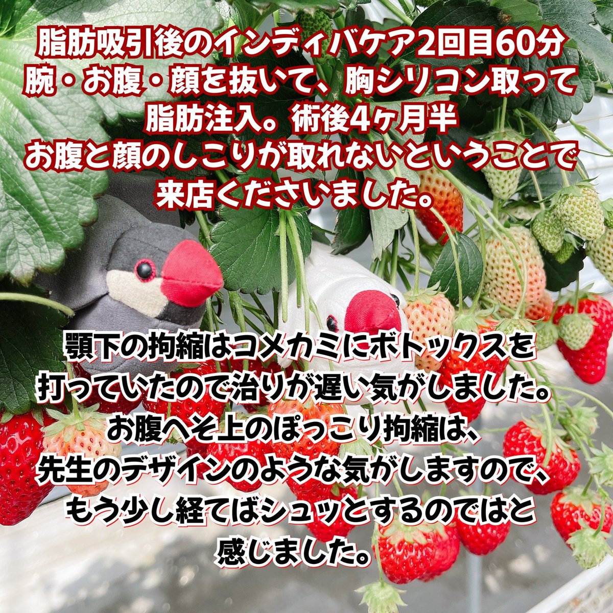 rainbowst78's tweet photo. #青山 #表参道 #外苑前
インディバサロン RainbowFactory78

#脂肪吸引 #拘縮ケア #脂肪吸引後ケア #インディバ #脂肪吸引後にインディバ #インディバサロン #ダウンタイム
#ジョールファット #バッカルファット #脂肪注入 #豊胸 https://t.co/5is42O8eBr