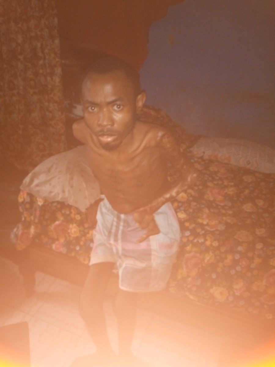KaluKaris's tweet photo. @cuppymusic Good EVENING DJ CUPPY please I really need your help am a sickle cell anemia patient,am really sick &amp;need ur help I have been diagnosed of oestoemalitics of the right knee&amp; tobacolosis of the bone it's affected my spinal cord I can't walk anymore since 2011.08139720887 https://t.co/cg8EFpY4AI